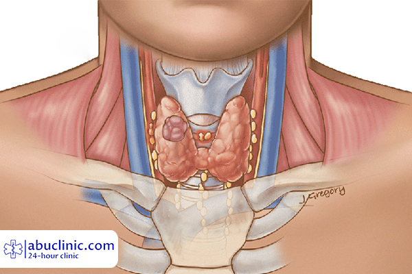 آزمایش هورمون تحریک کننده تیروئید (TSH Test)