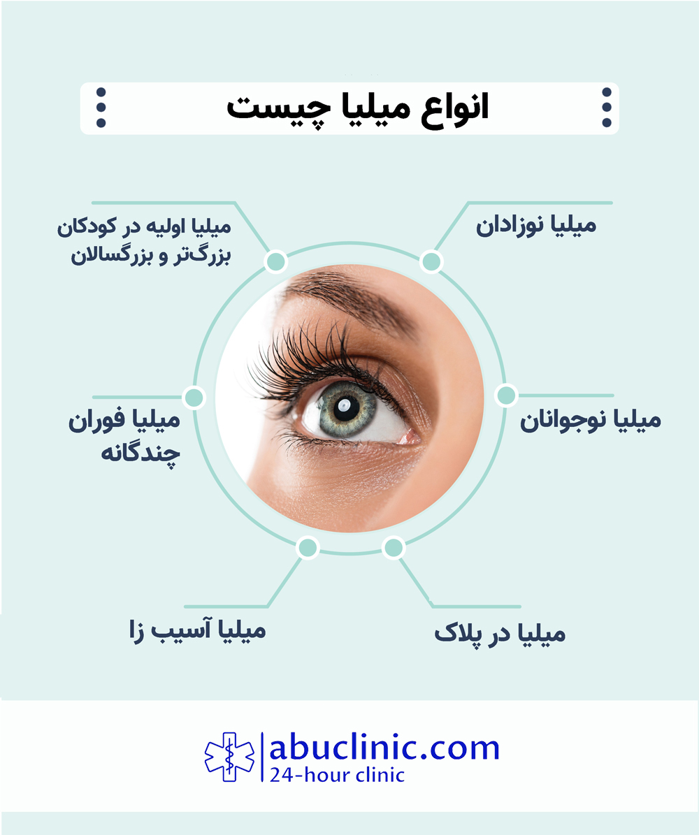 از میلیا چه می دانید؟! آیا خطرناک است؟