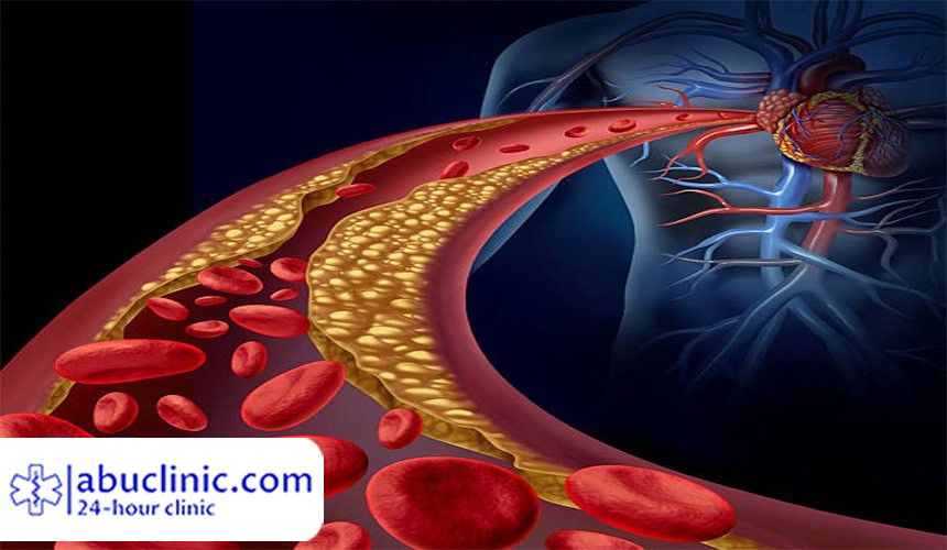انواع چربی خون چیست؟ کدام نوع چربی خون خطرناک است