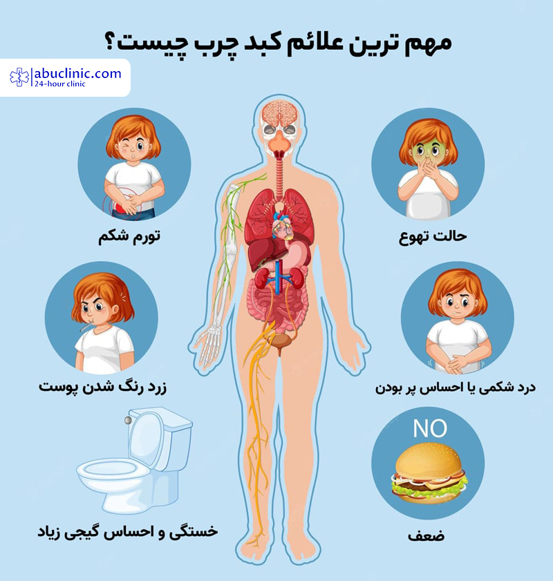 مهم‌ترین علائم کبد چرب در زنان و مردان چیست؟